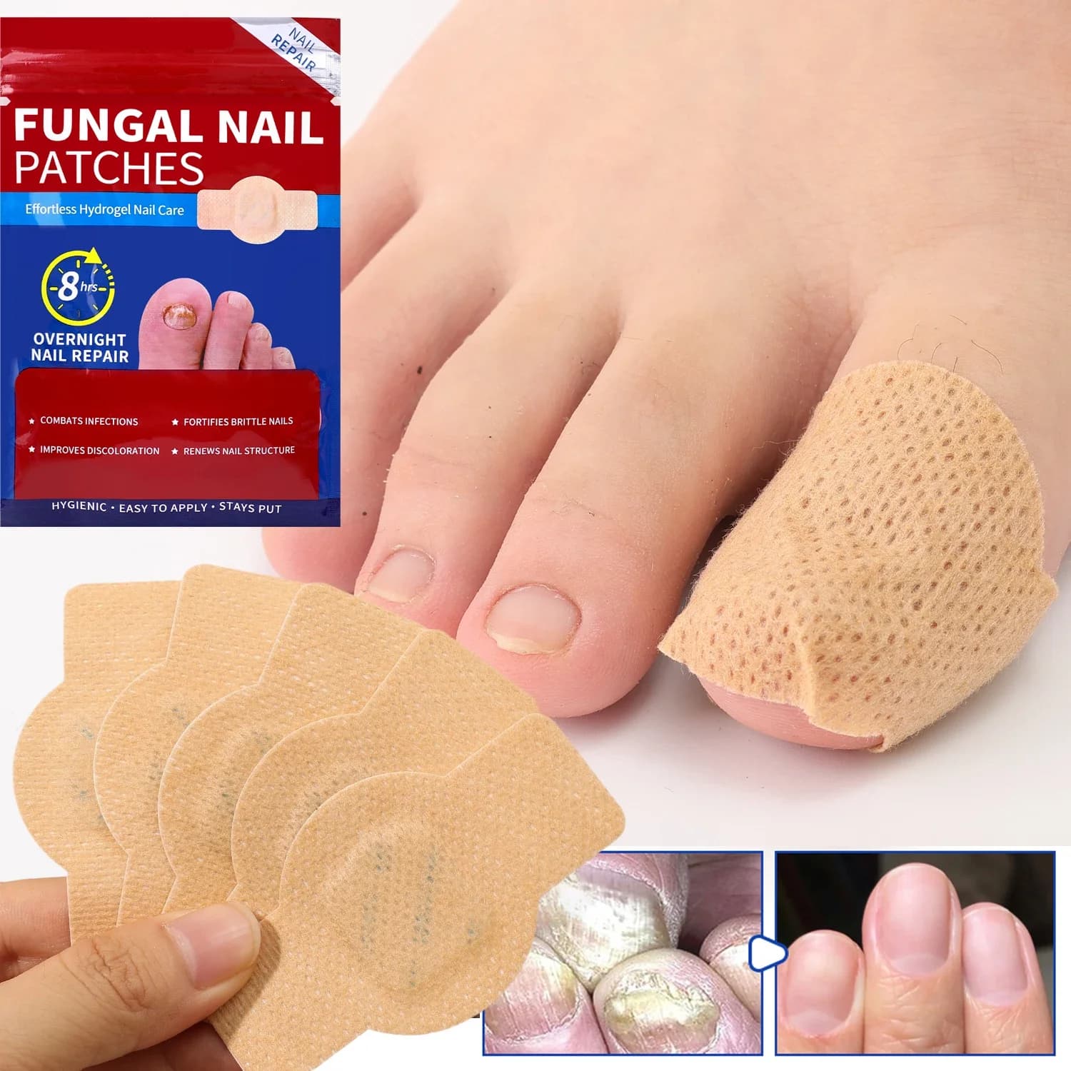 Nail Patch for Nail Patch for Repair Waterproof Nails Wall decal for correction incarnied Patch for care gray for damaged nails Tools for foot care