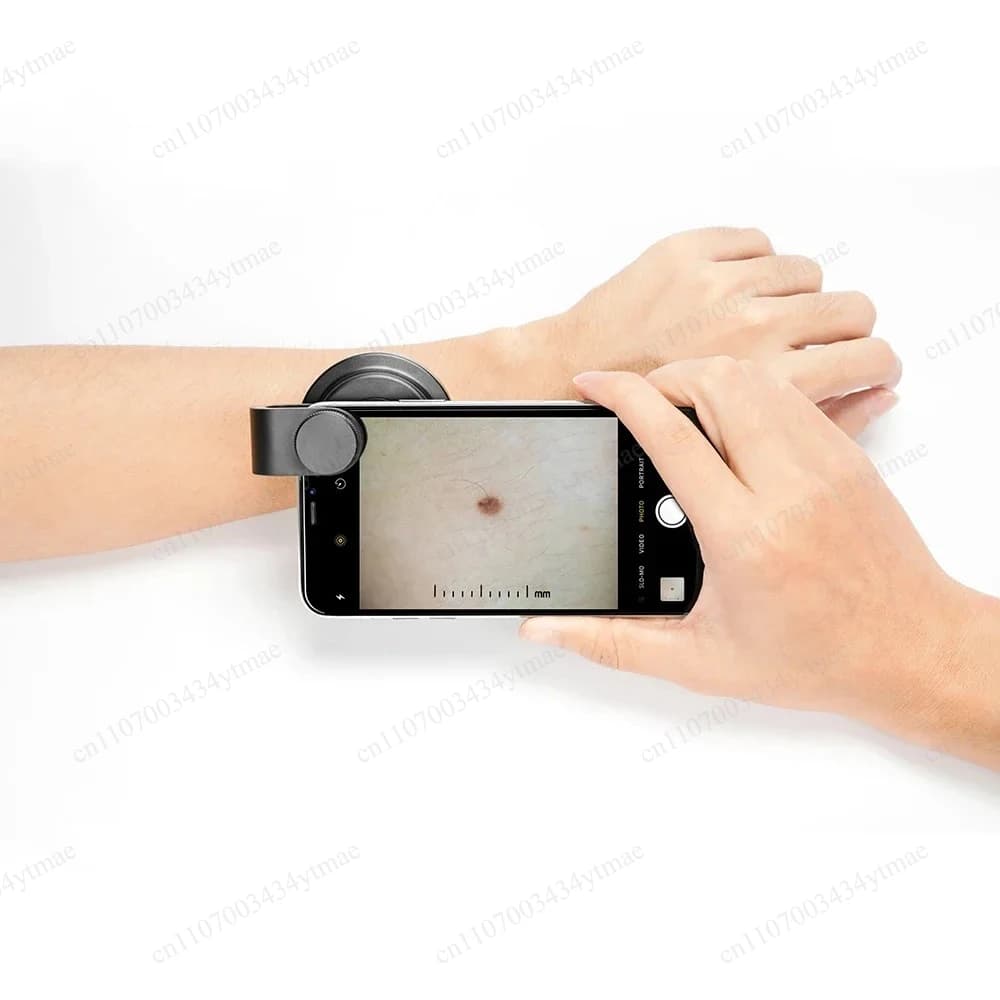 Dermatoscopio tascabile polarizzato ottico 10X per smartphone DE-400 per uso domestico