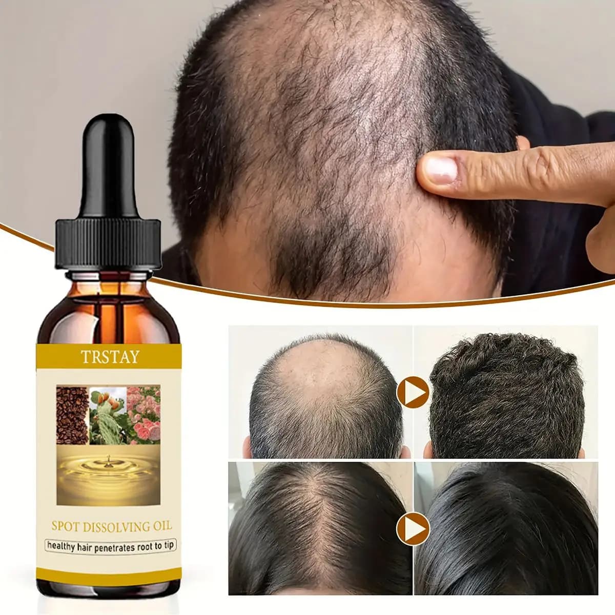 50ML Olio per la crescita della barba Oli essenziali per la ricrescita dei capelli anti-alopecia Essenza per uomo donna