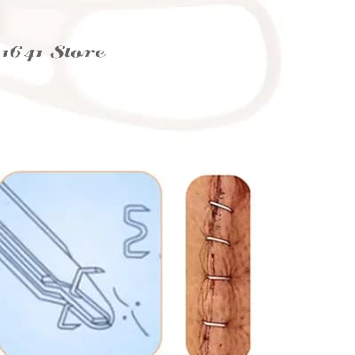 1 Pezzo Graffettore Chirurgico Monouso Bianco per Pelle, Strumento per Rimozione Chiodi in Acciaio Inossidabile + Estrattore di Chiodi in Plastica