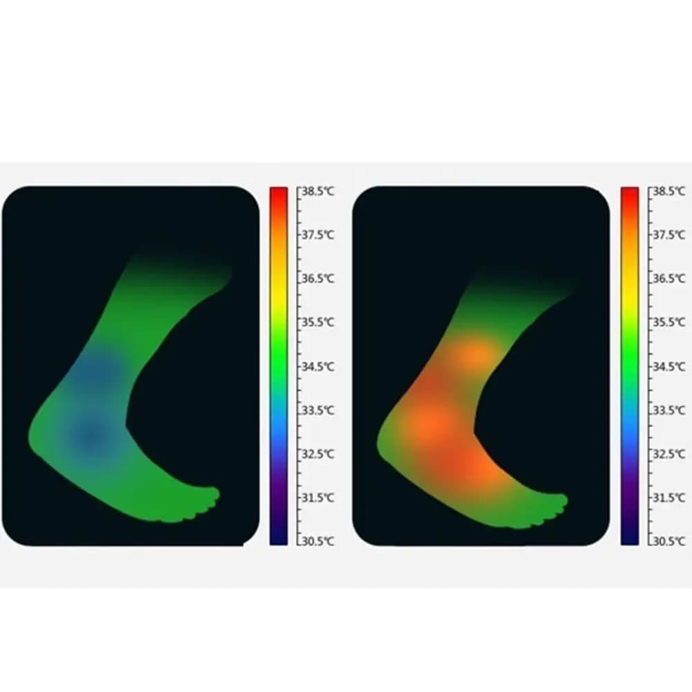 1 paio di cinghie di compressione regolabili per terapia magnetica, assistenza sanitaria, cintura avvolgente, supporto per caviglia, protezione del piede