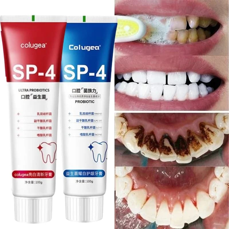 SP-4 Probiotic toothpaste Teeth whitening Remove plaque stains Teeth whitening Oral hygiene Clean Fresh breath Dental instruments 2025 NEW