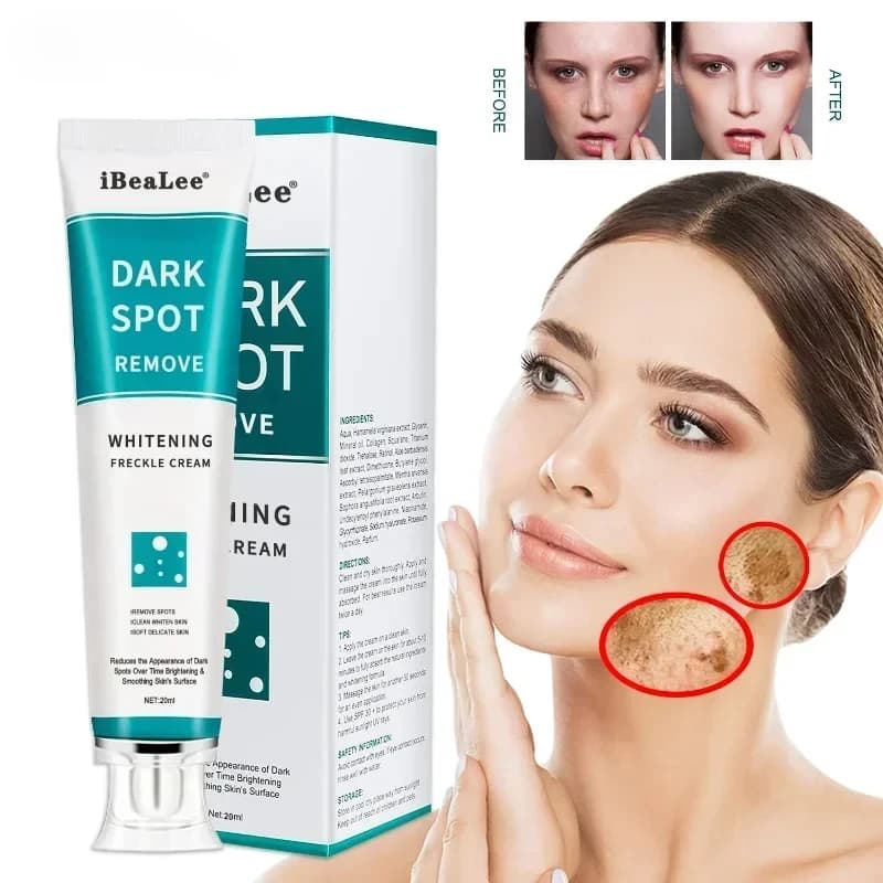 Whitening cream for freckles Remove dark spots Remove melasma Anti-lentiggine Cream Dissolvency Pigmentation Anti-aging Skin care