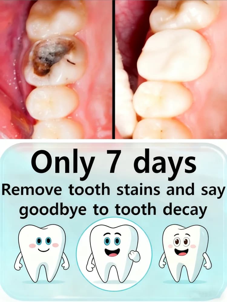 Daily toothpaste for the care of the gums: gentle formula, soothes sensitivity, deeply repairs the health of the gums and whitens the teeth