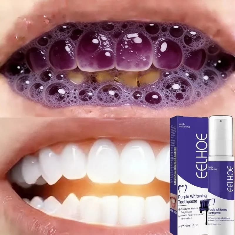 Dentifricio sbiancante per la rimozione delle macchie gialle, per mantenere l'igiene orale quotidiana, cura dei denti, uso domestico.