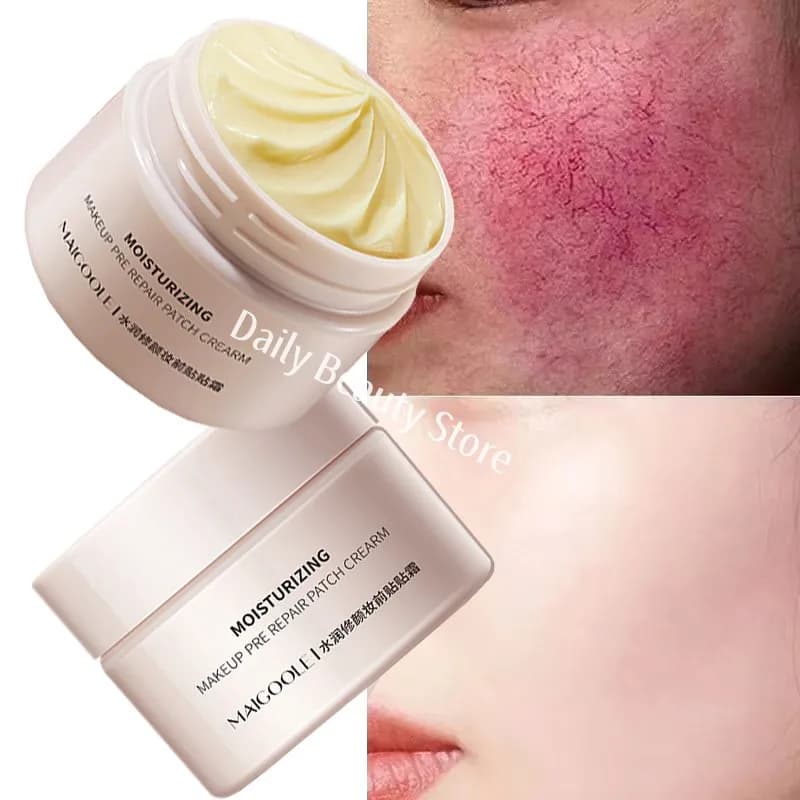 Crema riparatrice per il rossore del viso Migliora la secchezza della pelle sensibile Idratante Lozione lenitiva Rimozione Rosacea Cosmetici coreani