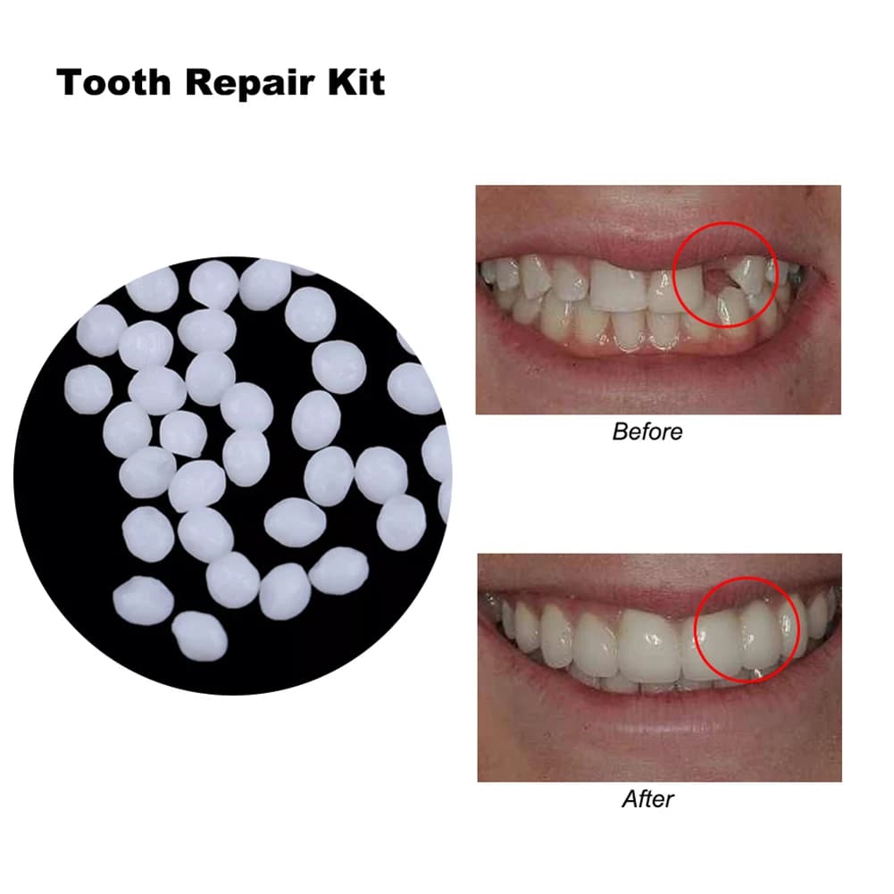 10/100g DIY Dentures Teether Handmade Solid Cavity Plugging Glue Temporary Tooth Hole Repair Materials Practical Teeth Whitening