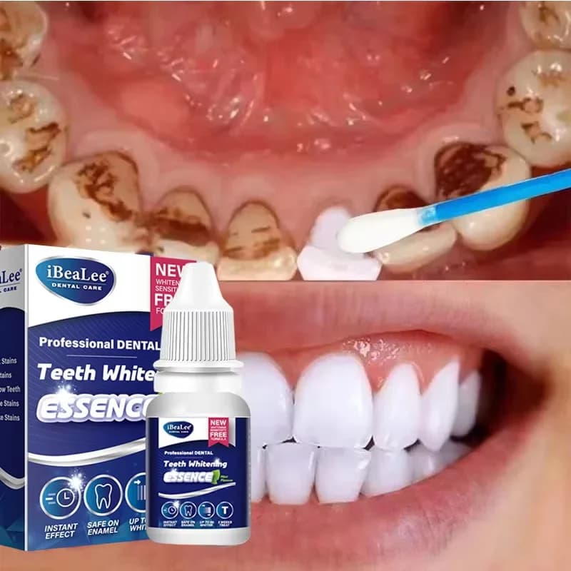 Teeth Whitening Essence Remove Plaque Stains Serum Fresh Breath Oral Hygiene Against Dental Caries Dental Tooth Cleaning 10ml