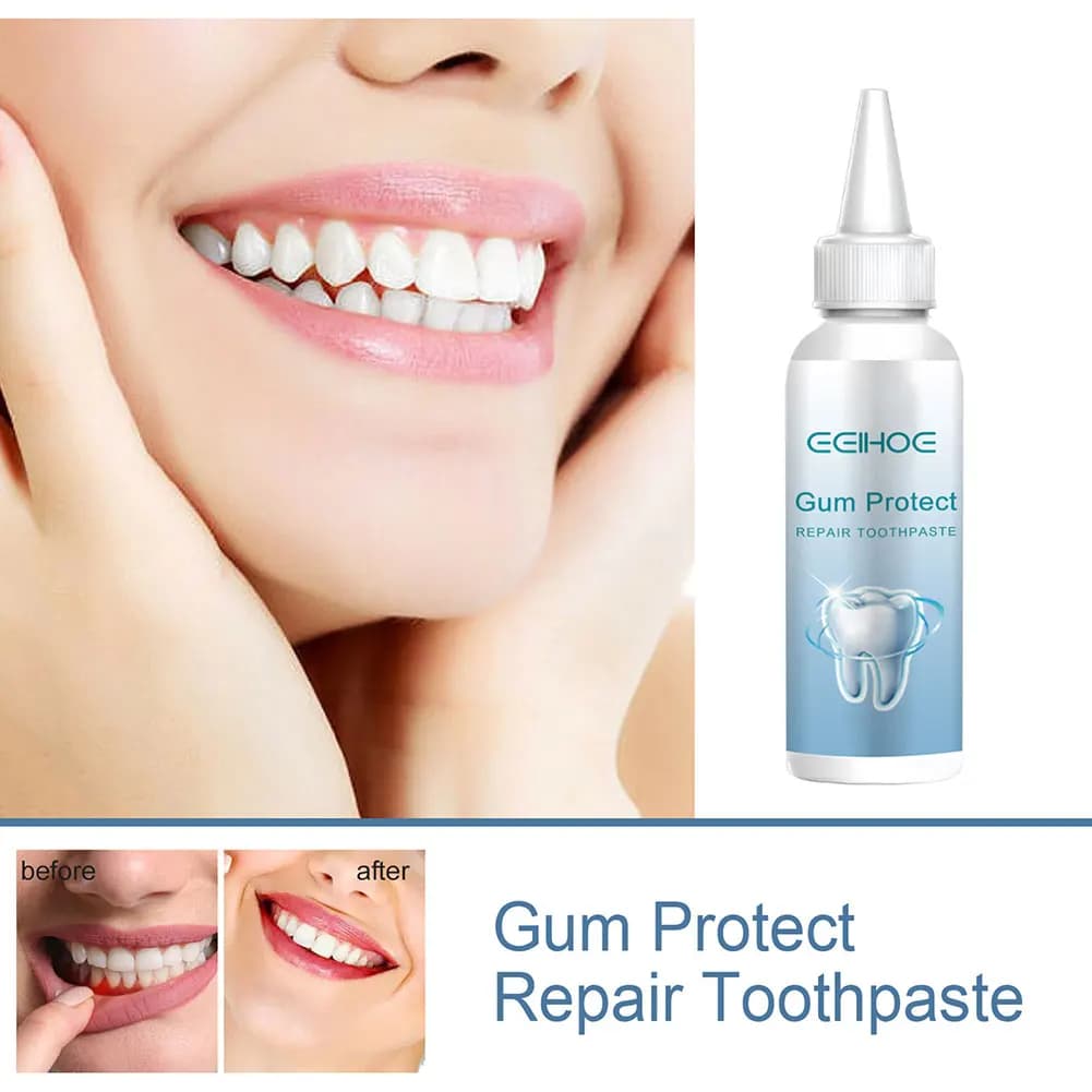 Gel di riparazione per la protezione delle gengive Allevia il dolore alle gengive Rimozione delle macchie del tartaro Penna per sbiancamento dei denti Protezione completa per la salute orale