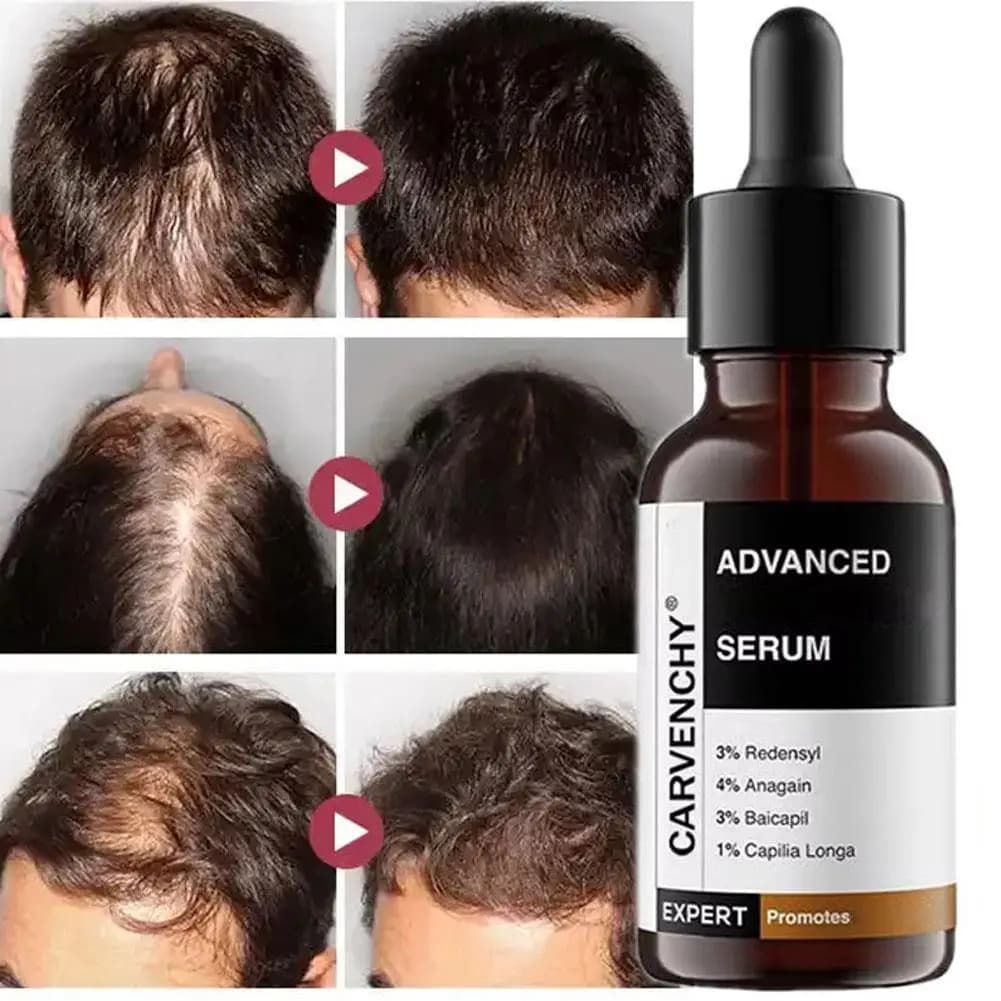Rosemary Essential Oil For Hair Care Improves Damaged Hair Dredges Blocked Follicles Activates And Growth Lubricates Hair