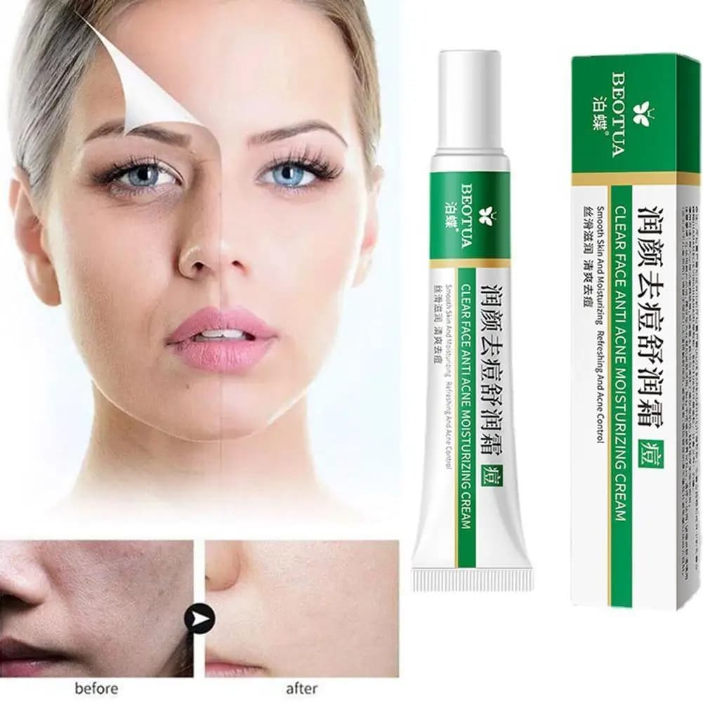 Hydrating Cream at the Aloe 20g, Siero Delicate for Skin Care, Reduces Subtle Rugs, Control Oil, Careful Macchie Scure, Pigmentation and Melasma
