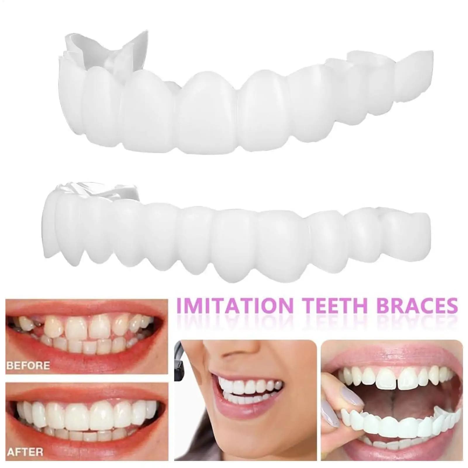 Set of silicone prostheses suitable for temporary orthodontic prostheses Fake teeth Oral Hygiene Care Whitening Prosthesis Simulation Bretelle