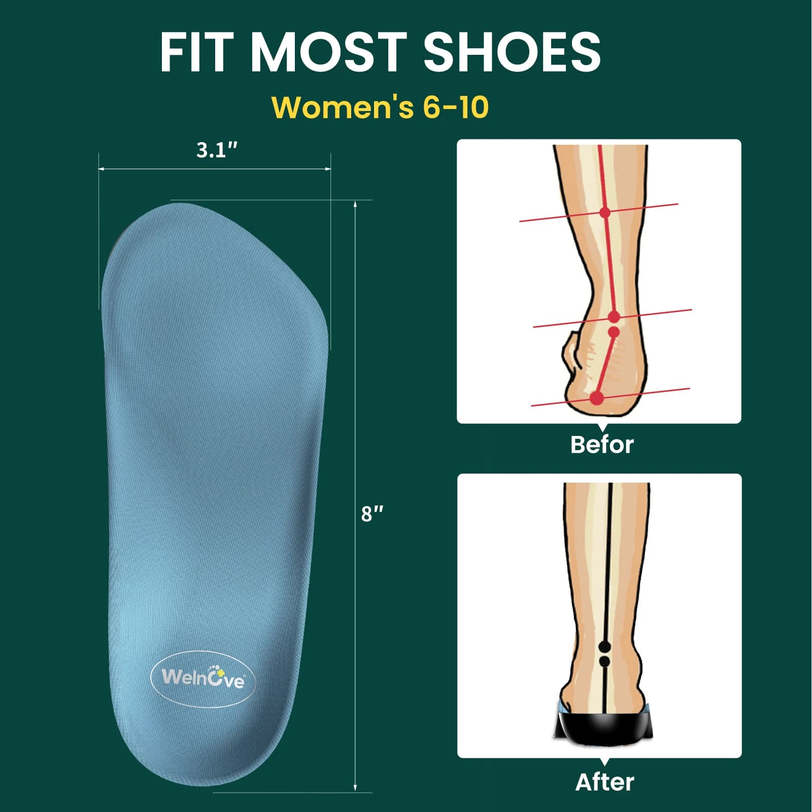 2 pcs support for arch plantar female soles elastic orthopedic soles for shoes technology unisex shock absorption breathable sports race