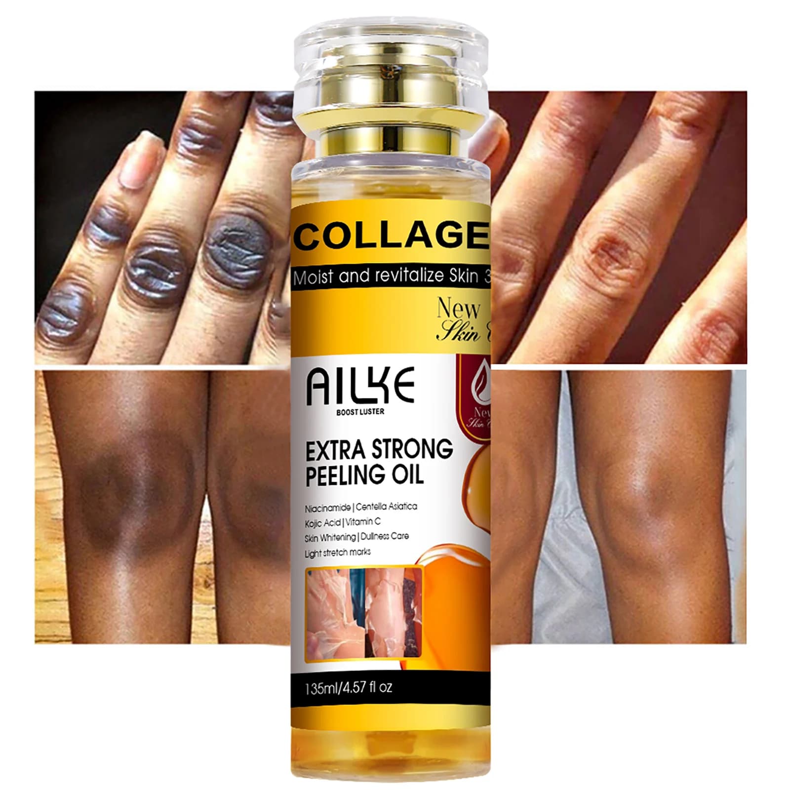AILKE Extra strong collagen peeling oil, whitening skin, exfoliating solution for face, body, hands, feet, for all skin types