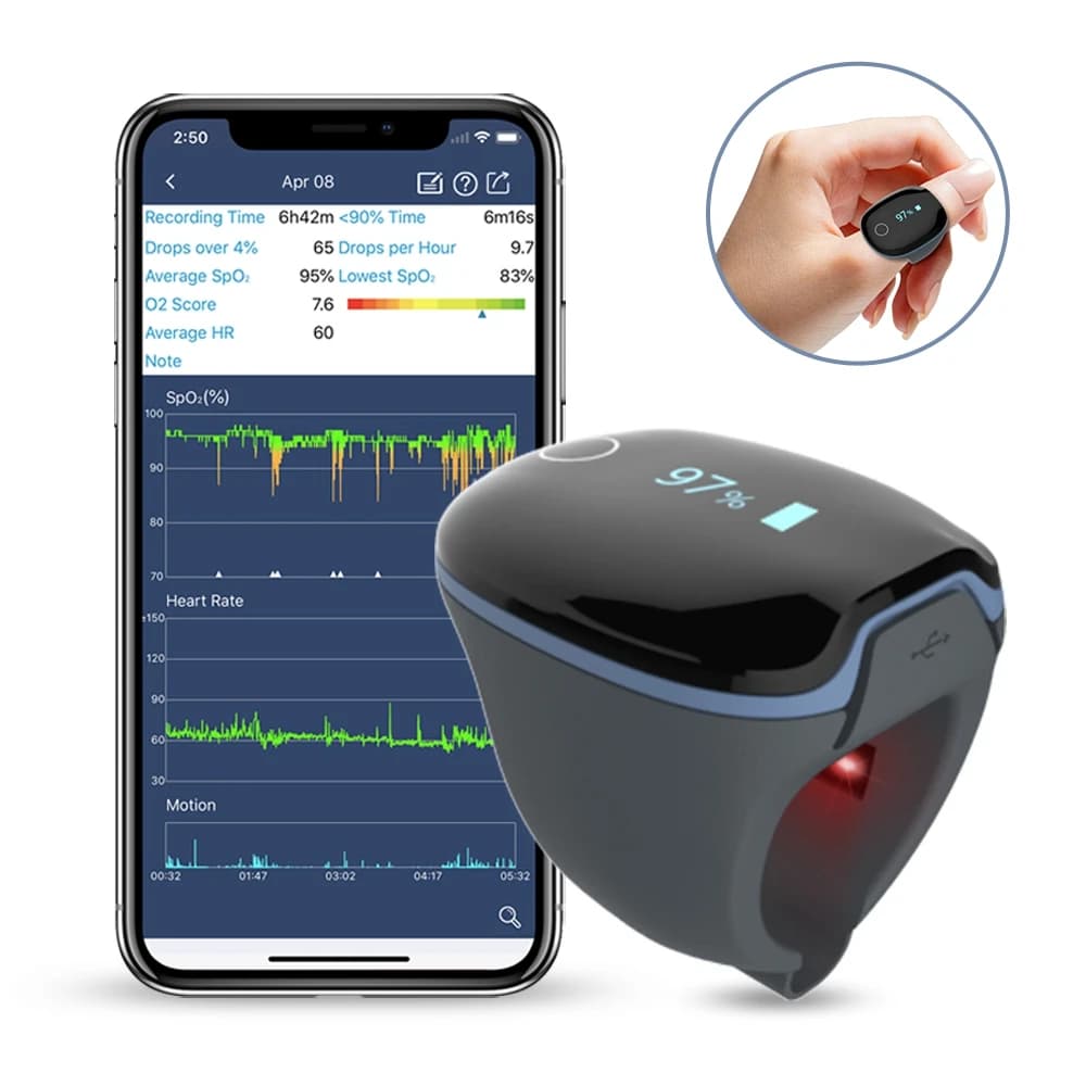 Dispositivi pazienti remoti Pulsometro Frequenza cardiaca Ossimetro veterinario Pulsossimetri a impulsi portatili
