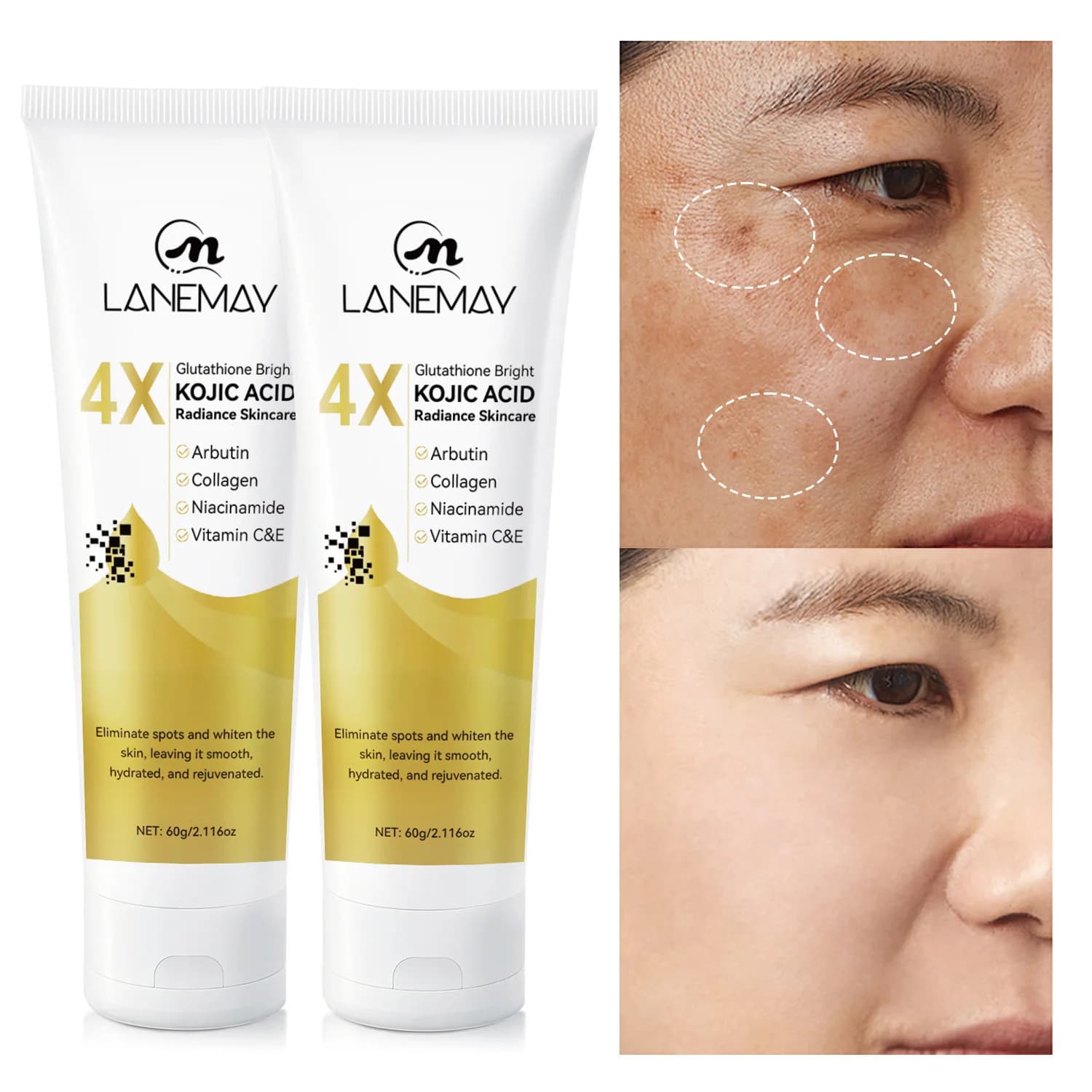 60g Kojic Acid Brightening Cream Glutathione Arbutin Vitamin C Moisturizing Concealer Lighten Dark Spots Skin Care For Men Women