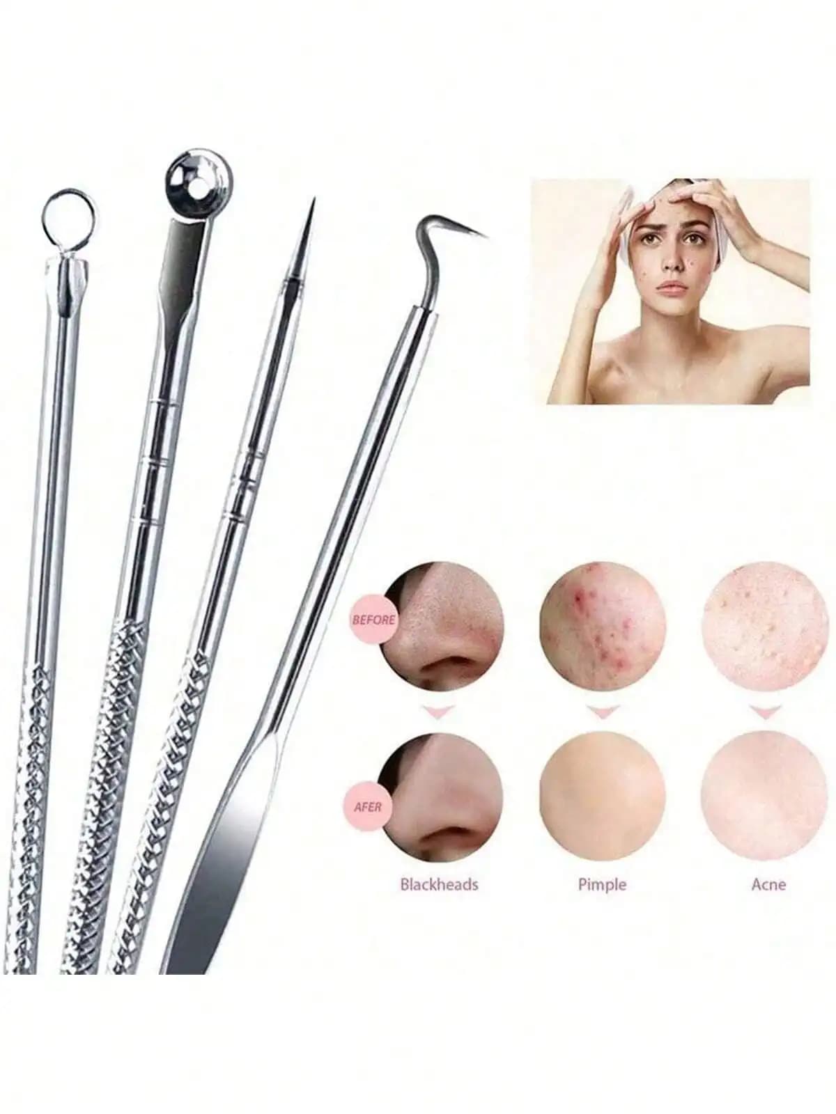 Kit di strumenti per la rimozione dei punti neri in acciaio inossidabile da 4 pezzi - Set di estrattori per acne e brufoli usa e getta per la cura della pelle del viso