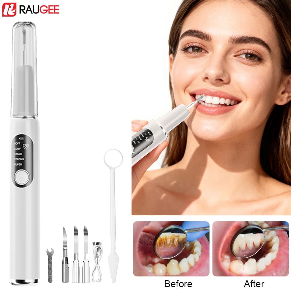 Ultrasonic Dental Scaler Electric Tooth Detergent Teeth Stone Removal Calculator Tartar Removal Teeth Whitening Oral Hygiene