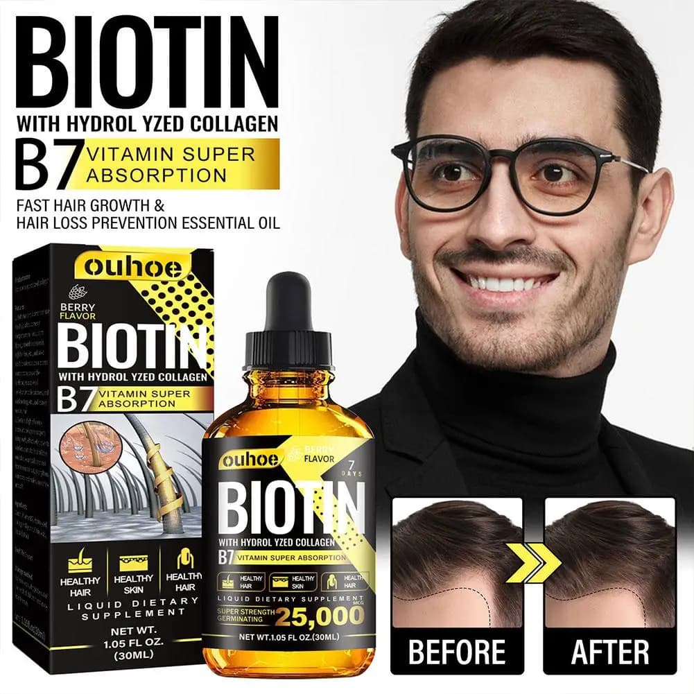 2023 new serum biotin oil for regrowth of hair fast treatment for thinning of liquid hair Anti-loss of hair for woman man hair loss Pro O5T7
