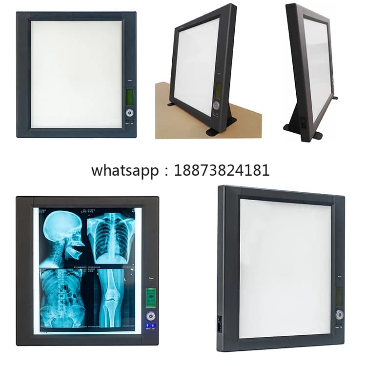 Visualizzatore di pellicole radiografiche GINEE MEDICAL a LED per pellicole radiografiche monofacciali, con visualizzazione quadrupla, spedizione rapida