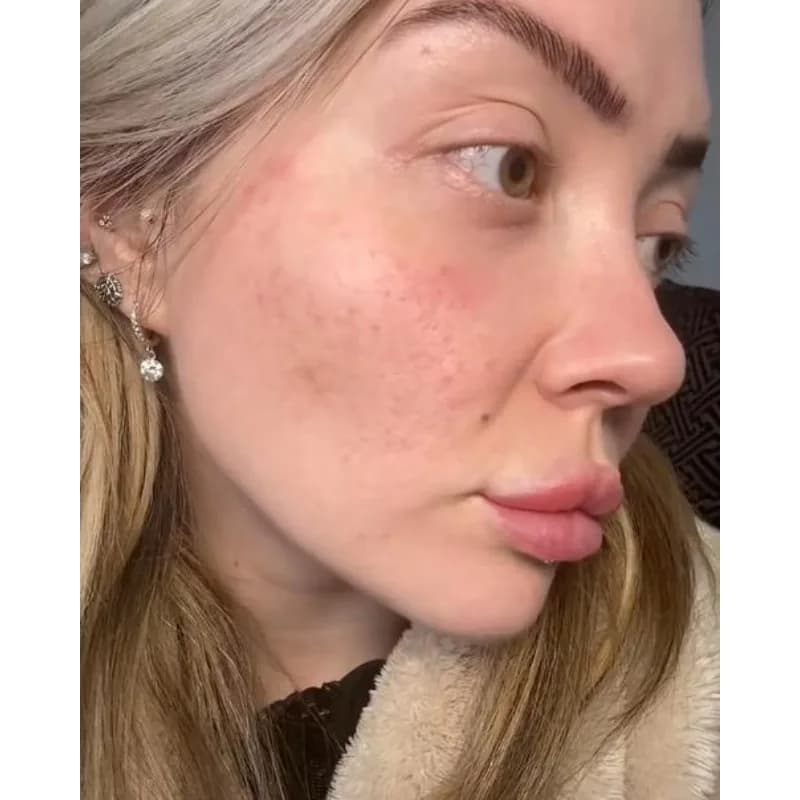 Facial Pore Shrinking Serum Fine Pores Firming Skin Increasing Skin Elasticity Moisturizing Brightening Essence Skin Care