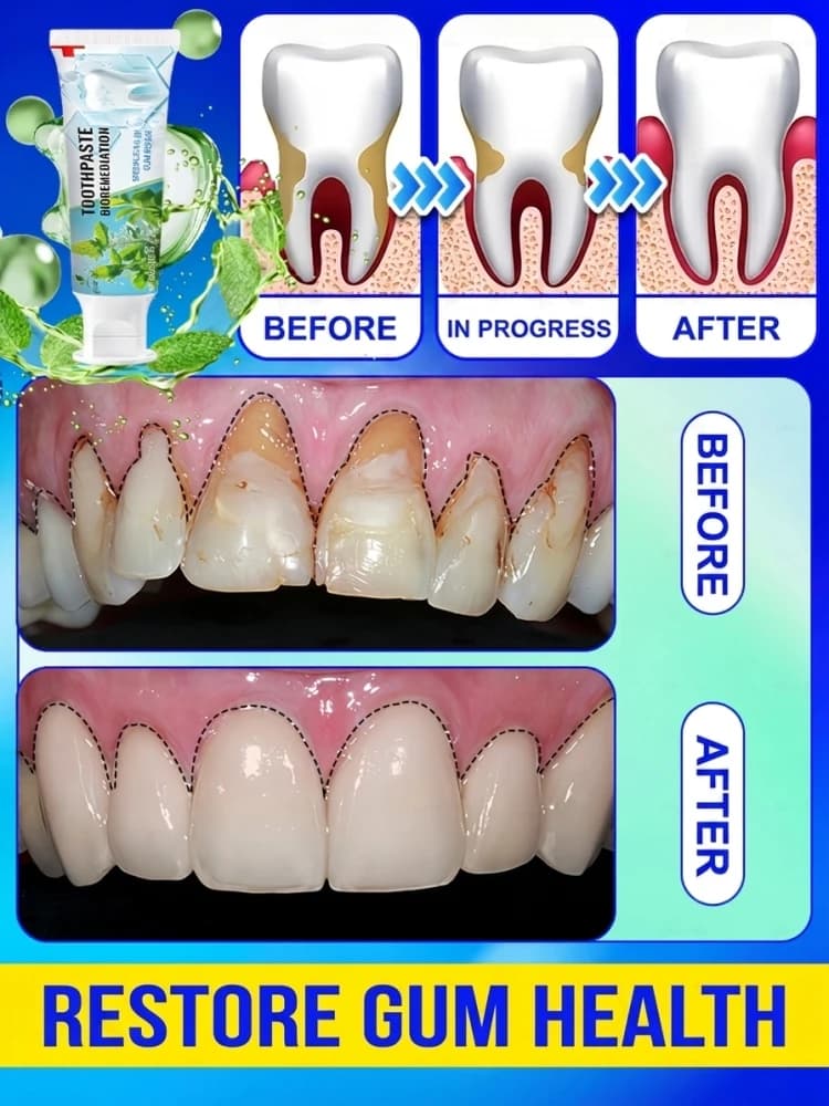 Probiotic Intensive Toothpaste for the Care of the Parents, Treatment for Gonfie and Sanguinants, Sbiancante for Sensible Tooths, Remove Macchie, Anti Bad Food, Long-Term Fresh Food, Deep Oral Cleaning, Adult Hygiene Product 60g