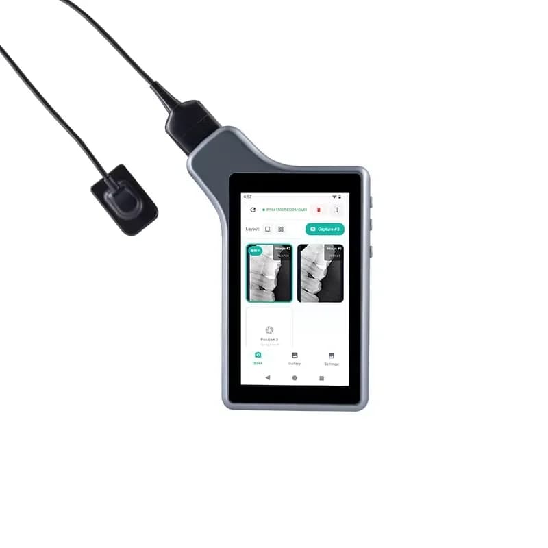 2026 New, High Quality, Portable All-in-One Intraoral X-ray Imaging System with Tablet Screen and Dental RVG Sensor for RX