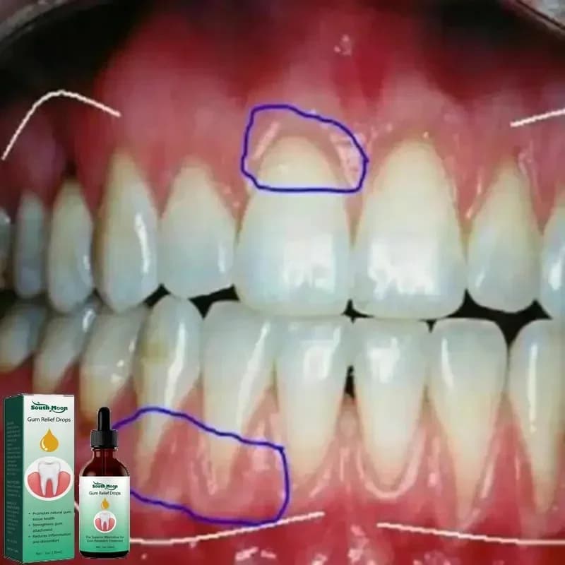 30ml quick repair of cavities Clean tooth caries mousse whiten remove yellow plate stains alleviate gums deform toothache