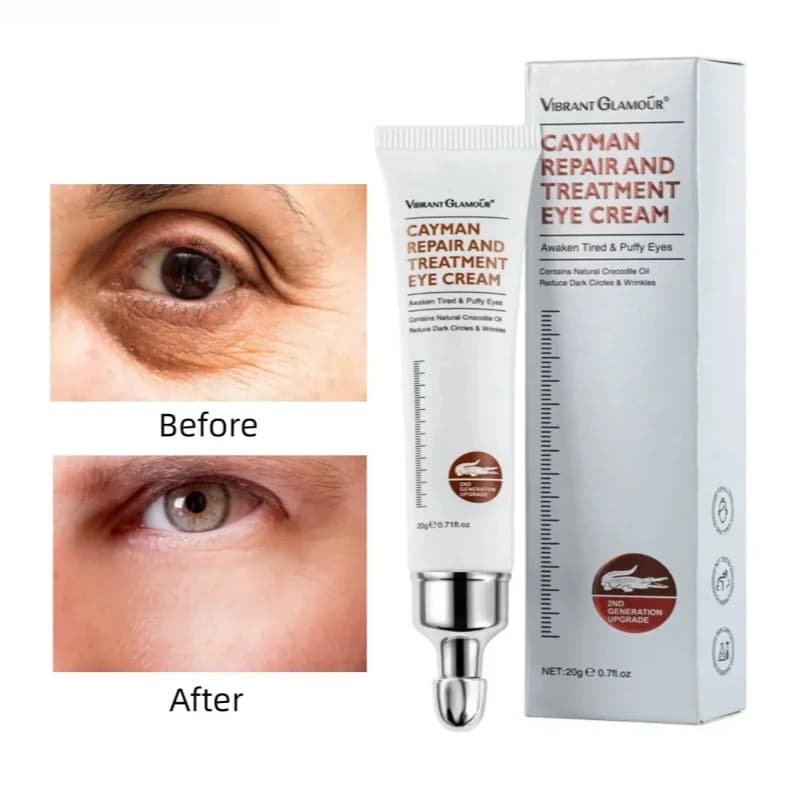 Cream Contour Eyes to the Collagen Peptidic 20g, Anti-Walk, Anti-Occhiaie, Anti-Borse, Repairing Gonfi Eyes, Care of Eyes (1/3/5 Pieces)