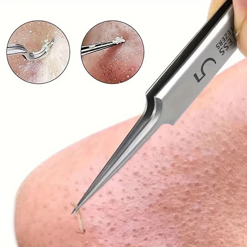 3/8-piece black dot removal kit – Imperfections and acne extraction tools in stainless steel – Professional set for pimple removal for all skin types