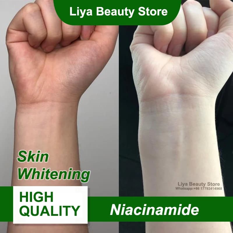 Best Seller Cosmetic raw material ingredients in niacinamide powder at 99% for skin whitening