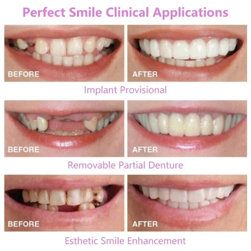 Denti cosmetici Spedizione gratuita Strumento di bellezza superiore Snap On Impiallacciature per sorriso in silicone Sbiancamento dei denti Copertura per denti finti Vestibilità perfetta