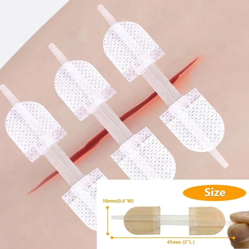 1 pz 45*10mm Cinghia Traspirante Cerniera Chiusura della Ferita Toppe E Stemmi Senza Soluzione di Continuità Elastico Zip Sutura Bende Per La Cura della Ferita Bretelle Supporti