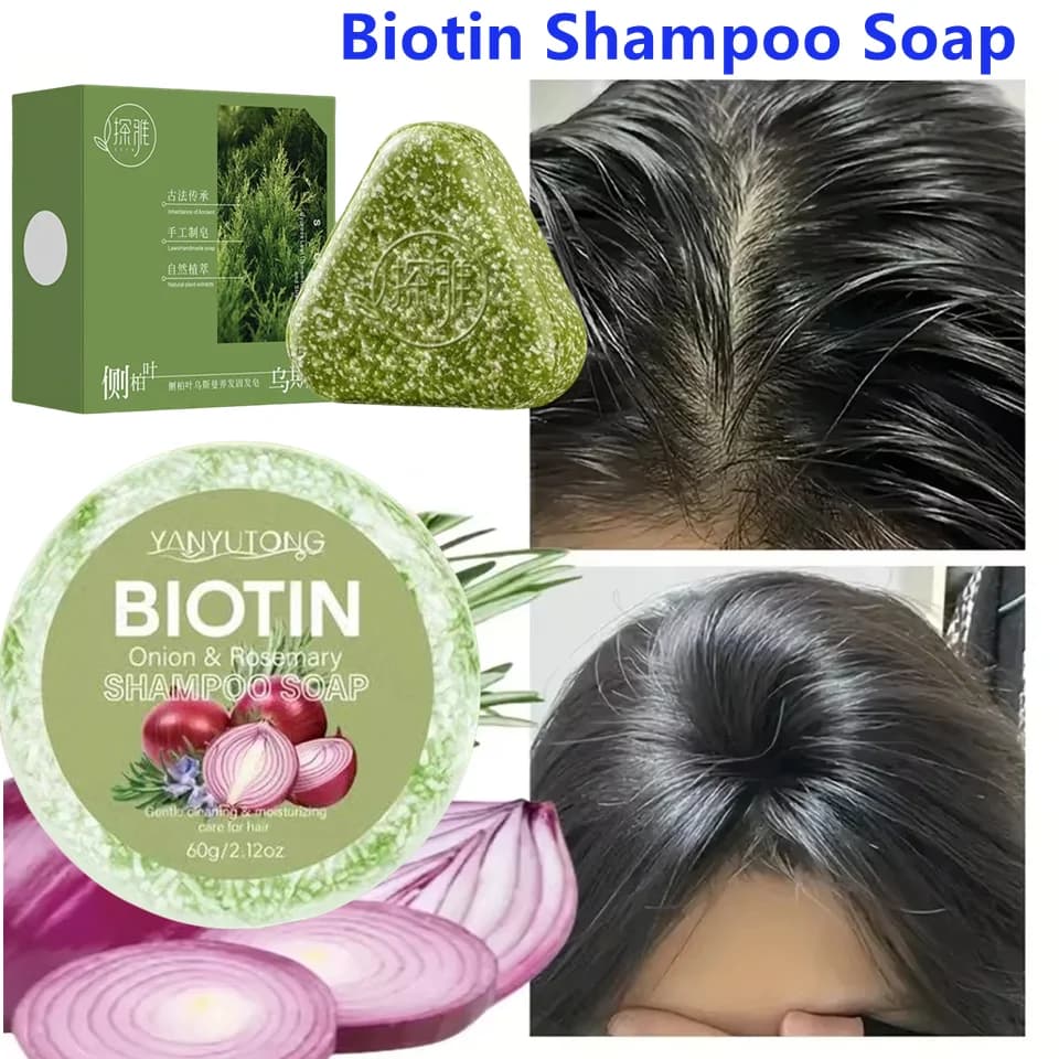 Onion extract Biotin Shampoo Flavour Fighting formula for natural dandruff with oil control Hydrating scalp care Healthy hair care