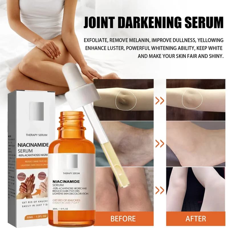 Whitening serum for dark knuckles Elbow Arms Beach serum Woman Private Part Skin Clasps dark knuckles Strong whitening serum