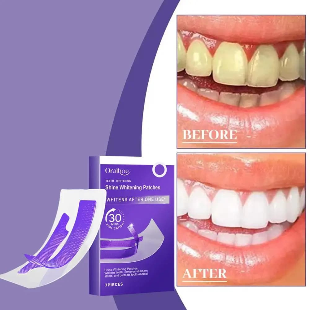 Kit di Cura Dentale con 7 Strisce Sbiancanti per Denti, Pulizia Delicata, Cura Orale Quotidiana, Sbiancamento Rapido, Rimozione delle Macchie