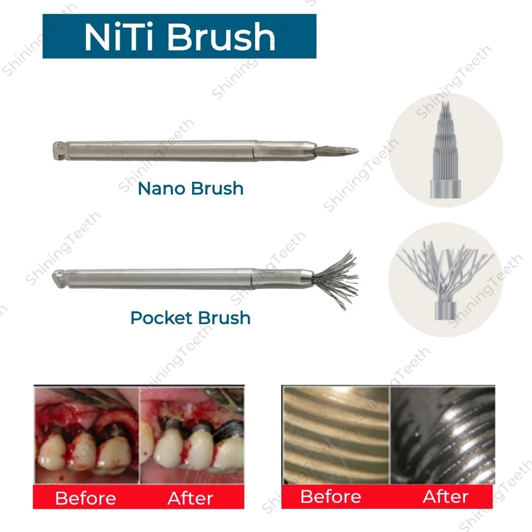 Spazzola Dentale in NiTi per Debridement, Pulizia della Superficie dell'Impianto, Trattamento Peri-Implantite, Manutenzione e Restauro Implantare