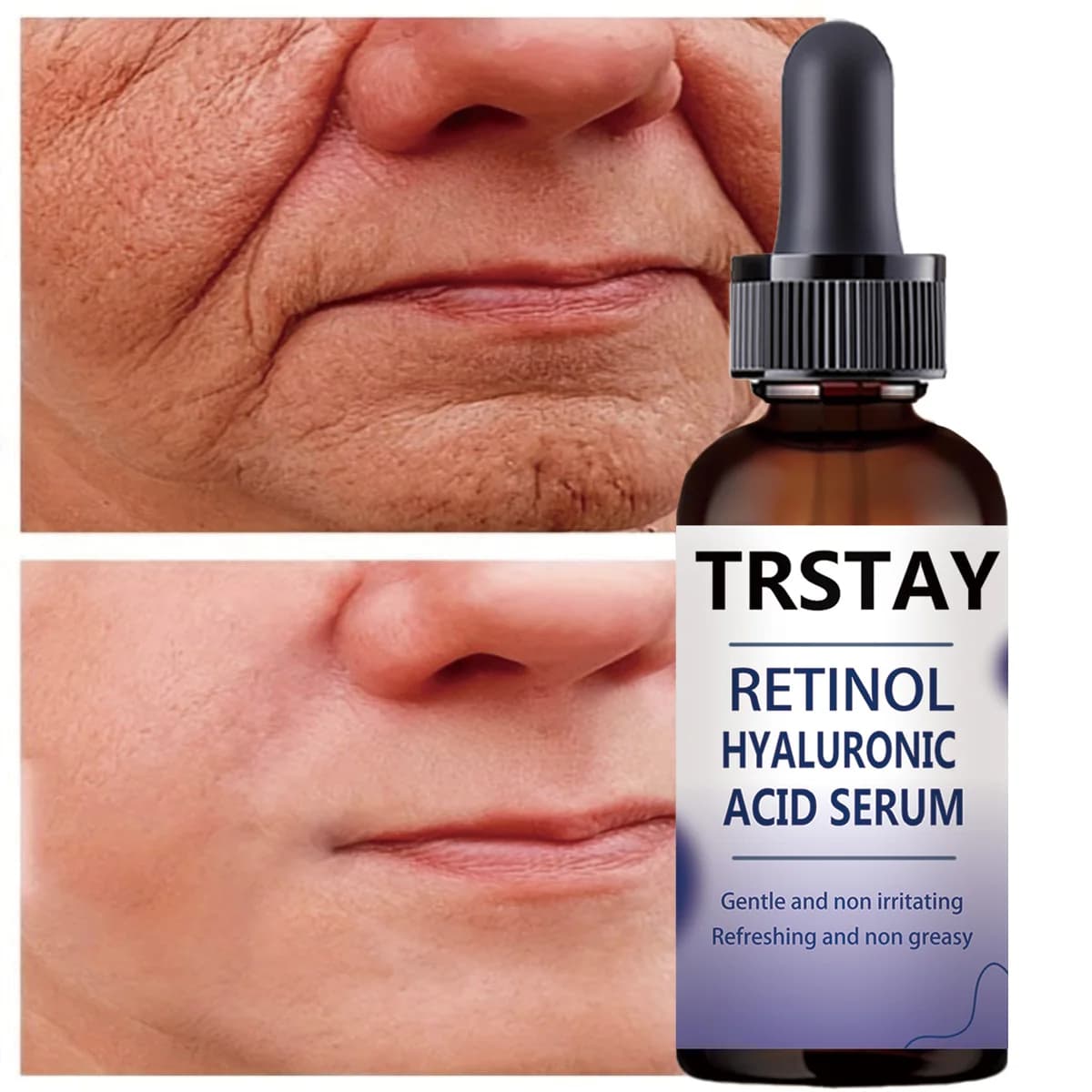 Retinol Hyaluronic Acid Serum, Gentle and Non-Irritating, Refreshing and Non-Greasy, Helps Improve Skin Condition