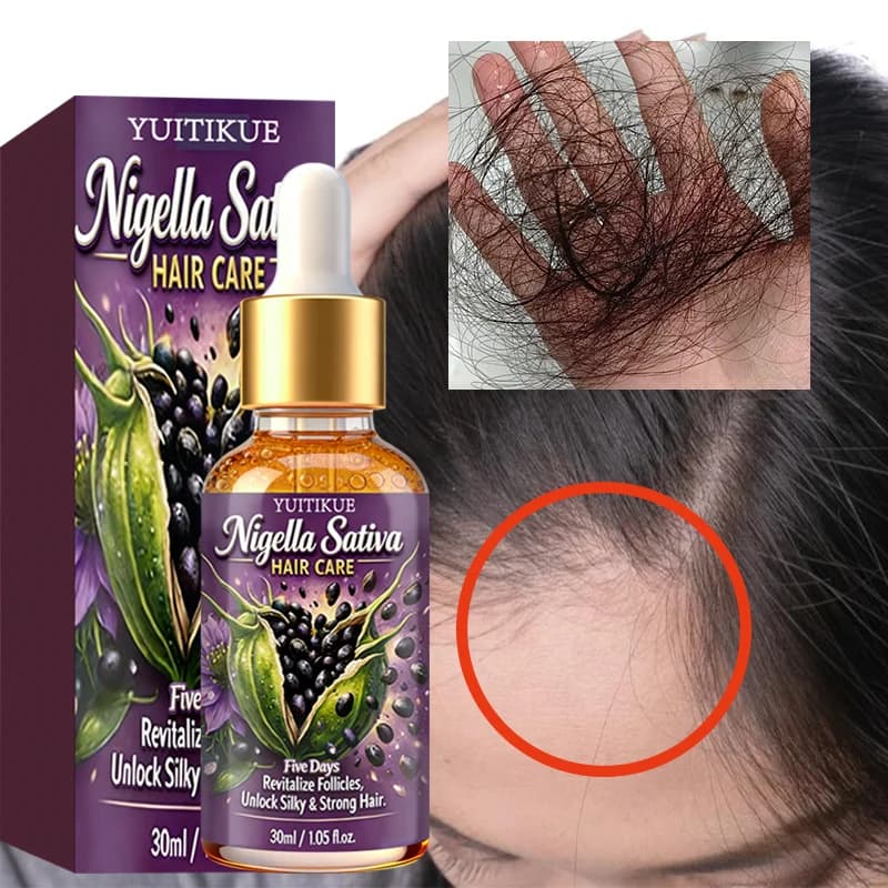 YUITIKUE Nigella Sativa Hair Oil - 30ml Revitalizing Oil for Follicles in 5 Days for Silent and Strong Hair