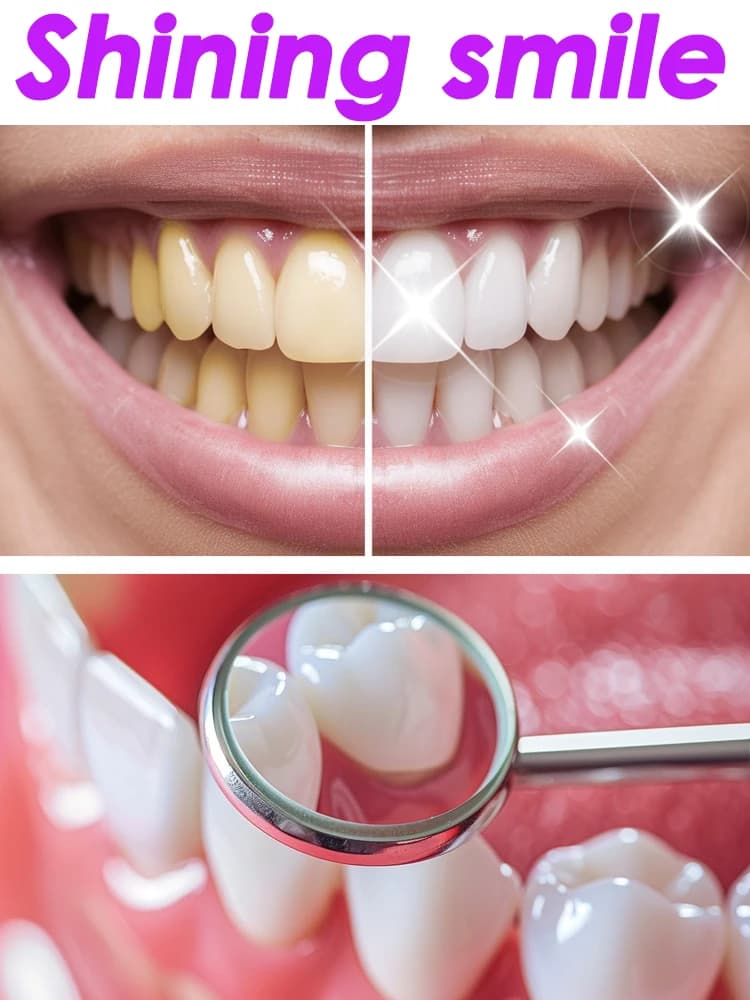 GlorySmile Teeth whitening Fruity toothpaste Products Dental plaque Tartarus Fluorosis Cleaning Prevent tooth caries Oral hygiene