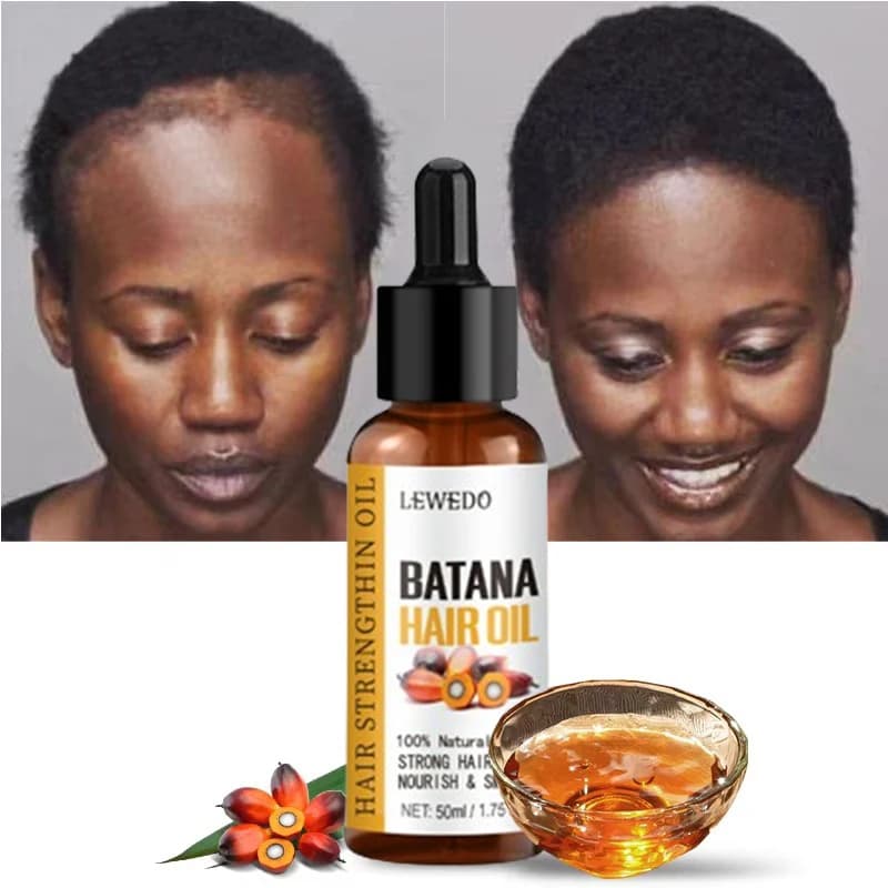 Lewedo Naturals Batana Oil Grows Quick Hair Hair for Women Of Men Pure Batana Oil Feeding Hair Polishing Healthcare Anti Hair Loss