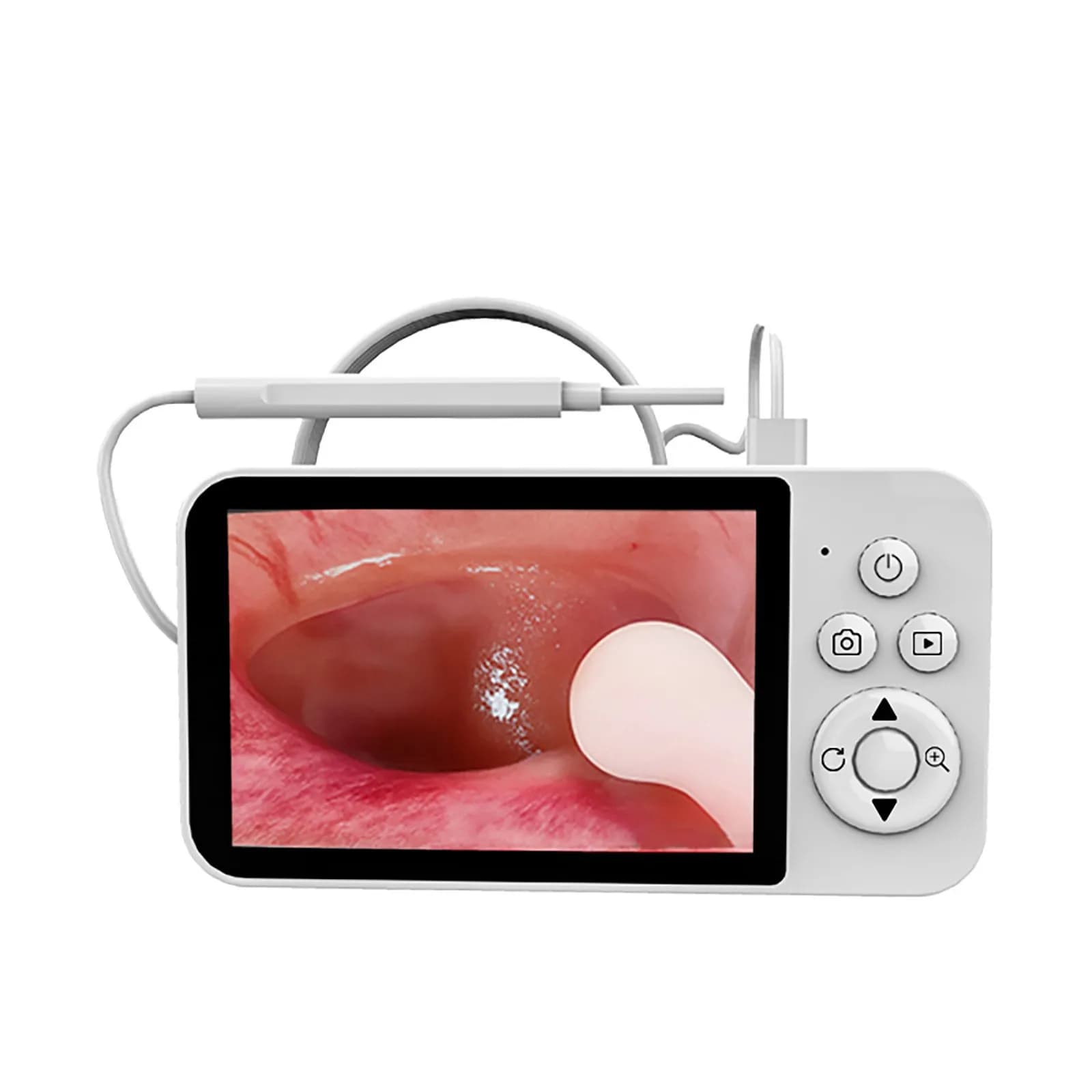 Otoscopio Endoscopico Wireless HD 720P da 4.3 Pollici 3.9mm per Visuale Ispezione Orecchie, Capelli, Naso e Pelle - Microscopio Digitale per Pulizia Auricolare