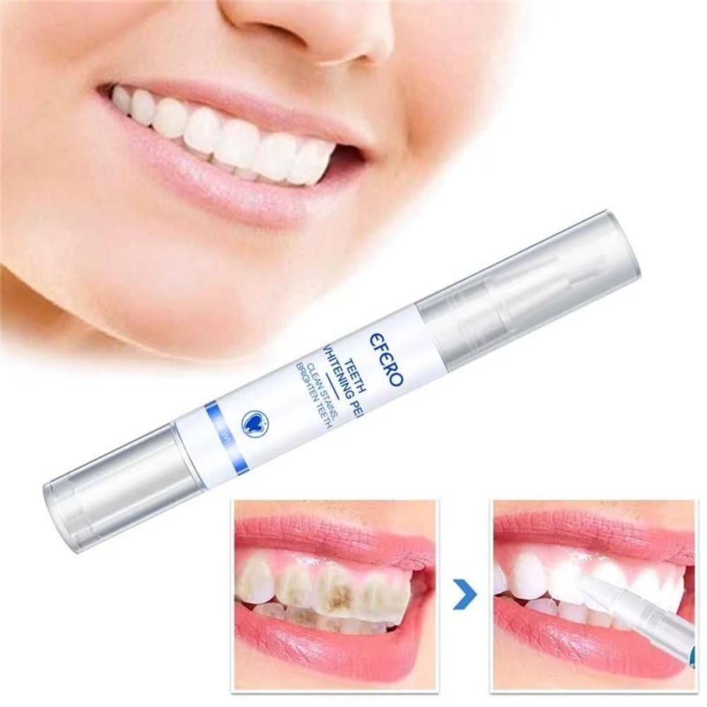 Siero sbiancante per denti Putim, rimuove le macchie e la placca, igiene orale, strumenti per sbiancamento dentale, alito fresco, cura dei denti