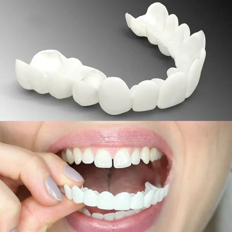 2026Dental Copertura Dentale Superiore per Denti Finti, Faccette per un Sorriso Perfetto, Protesi Flessibile e Confortevole per Sbiancamento, Attrezzatura per Denti CK848-FRO