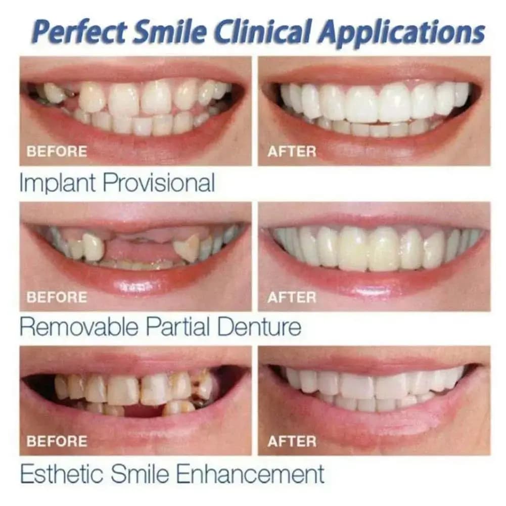 Bestseller Kit per Denti Finti Temporanei, Sbiancamento Dentale, Sostituzione Temporanea dei Denti per Uomini e Donne CK848-FRO