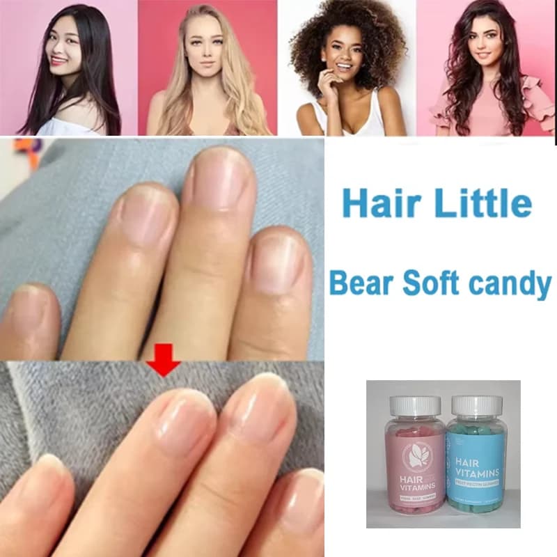 1 set of vitamin gums for hair to promote hair growth, regulate endocrine system, improve nutrition of hair health supplement