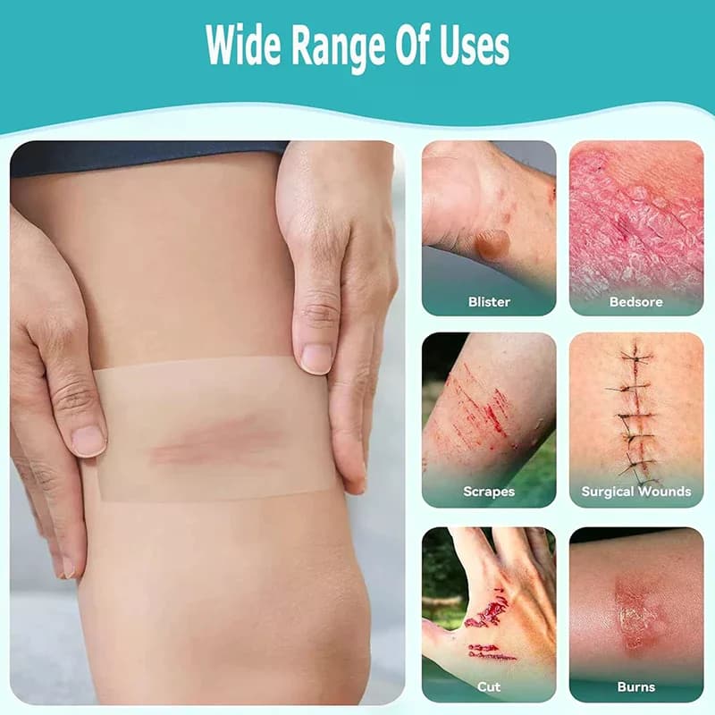 Rotolo idrocolloidale altamente assorbente per la cura delle ferite Bende idrocolloidali con bende autoadesive e doloranti da letto