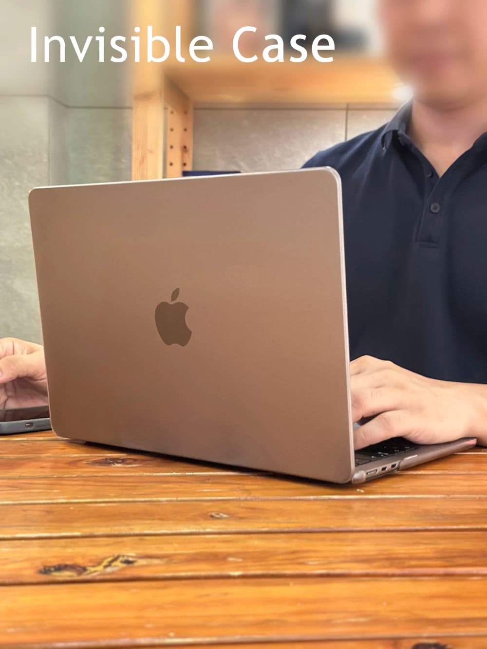 Invisible Laptop Case for Macbook Air 13 Case M1 M2 M3 M4 M5 Pro 14 16 Funda Para Mac Air 15 Pulgadas Advanced 2026 Laptop Shell