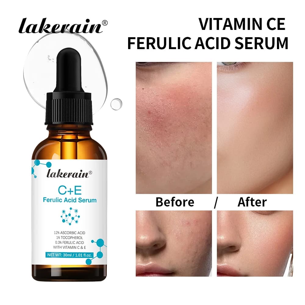 Serum face to vitamin C Reduces dark spots Acne scars Provide firming Decreases thin lines Face Essence Korean product for skin care