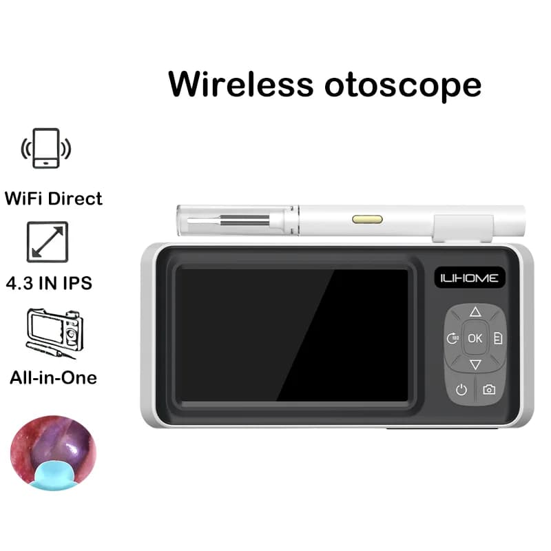 4.3 Inch Digital Otoscope with Endoscope Camera for Wireless Ear Point-Point Support for Ear Care Video Photo